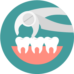 Tooth Extractions