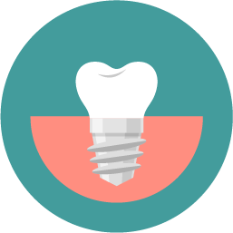 Dental Implant Restoration